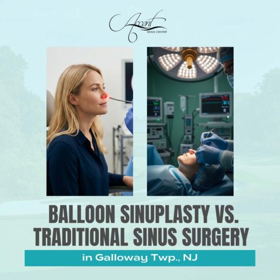 Balloon Sinuplasty vs. Traditional Sinus Surgery in Galloway Twp., NJ