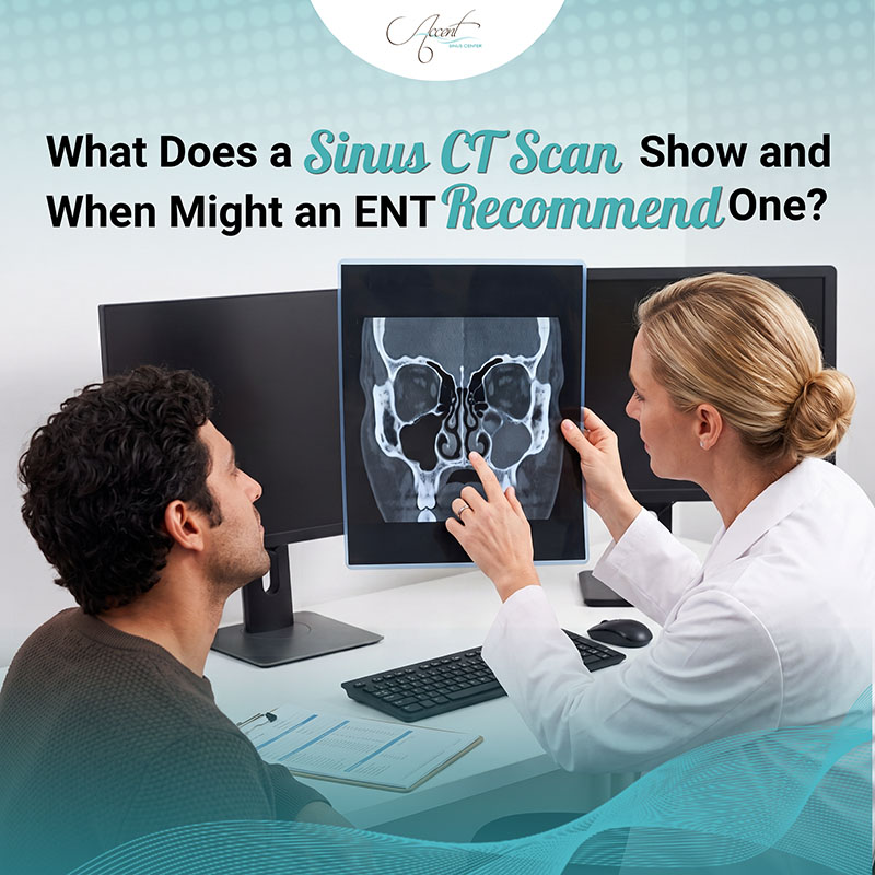 Sinus CT Scan Sinus CT Scans
